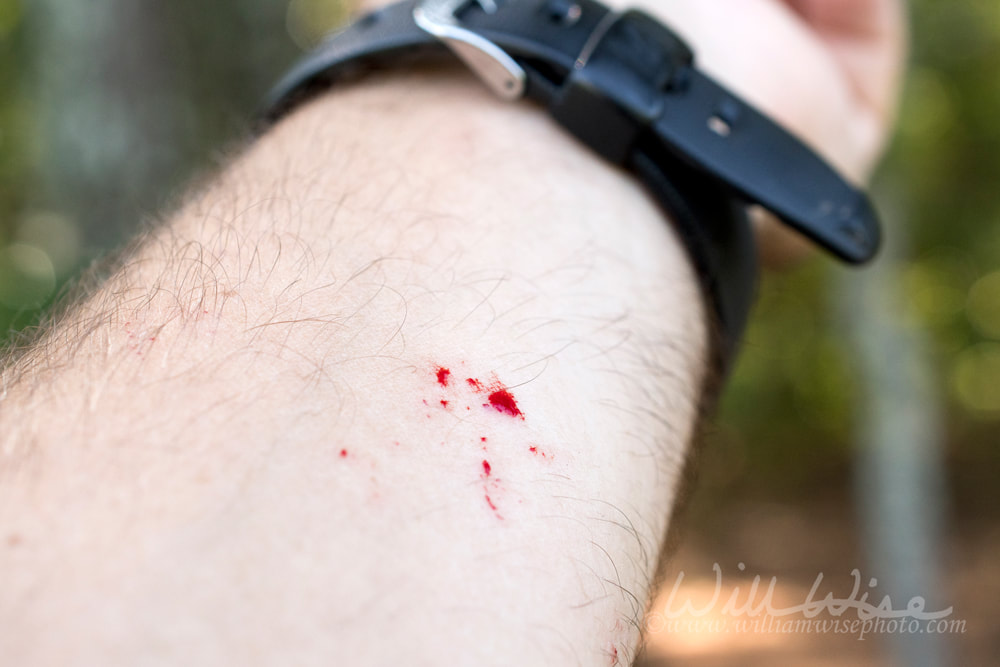 Snake bite close up Picture